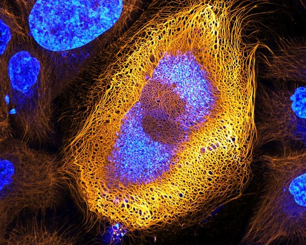 Nikon Small World